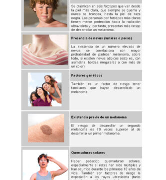 Causas del melanoma