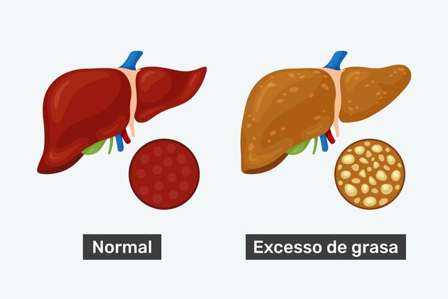 Imagen ilustrativa número 3